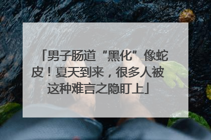 男子肠道“黑化”像蛇皮！夏天到来，很多人被这种难言之隐盯上
