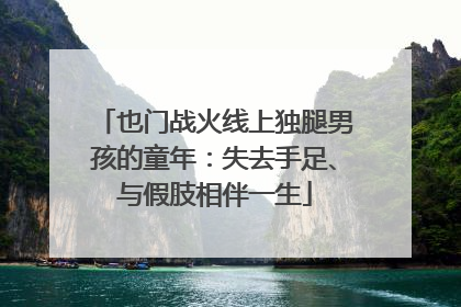 也门战火线上独腿男孩的童年：失去手足、与假肢相伴一生